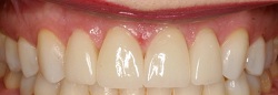 Caguas Smile Center