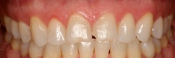 Caguas Smile Center